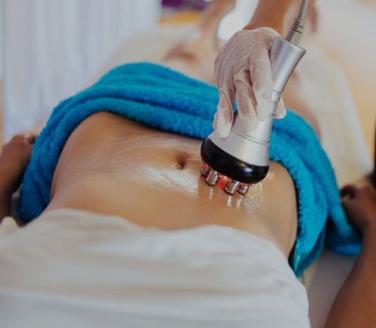 RF Body Skin Tightening (30 minutes)