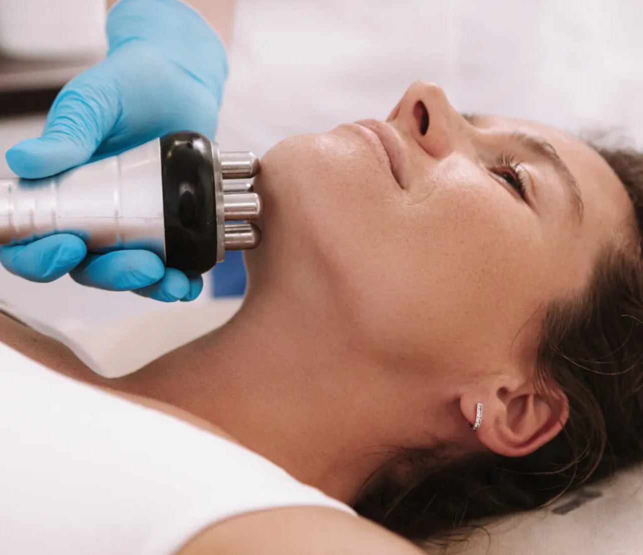 RF Face and Neck Skin Tightening and Contouring (30 minutes)